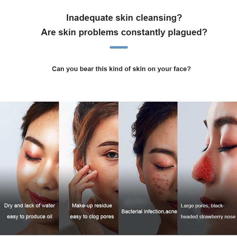 BubbleVac Electric Blackhead Remover