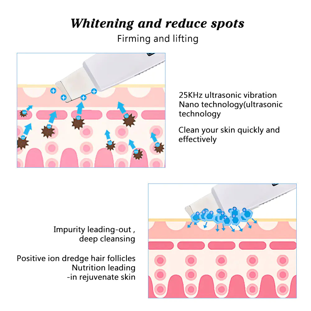 elynoura™-purepore-ultrasonic-facial-cleanser-pore-vacuum