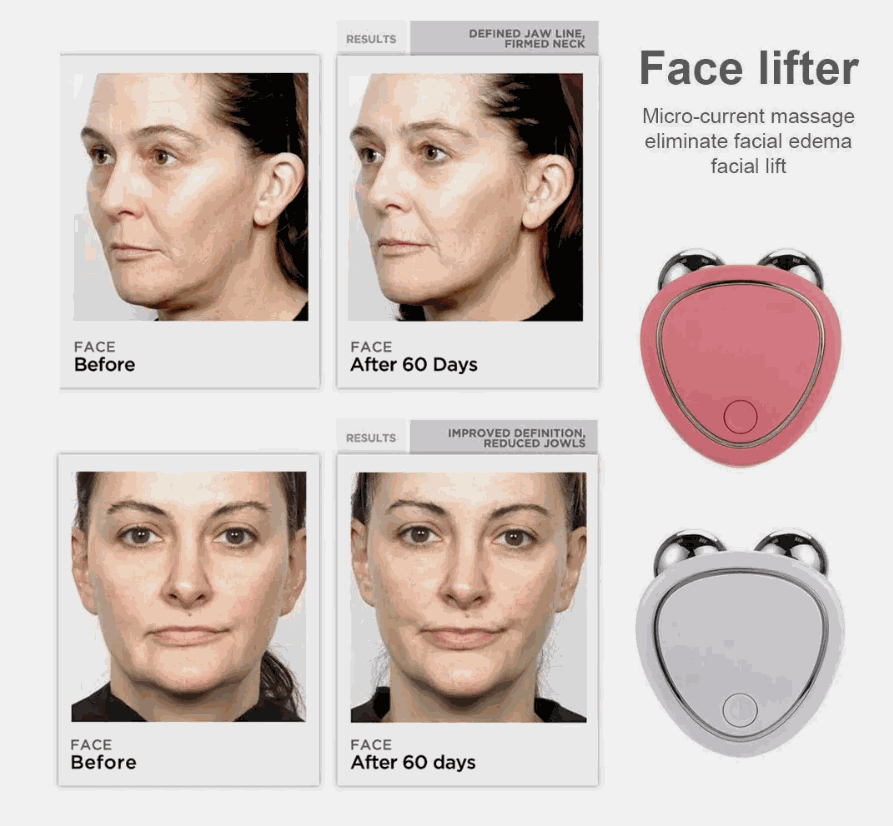 Elynoura™ RadianceLift Pro