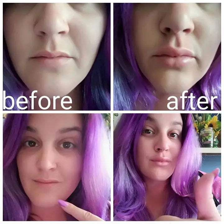 Elynoura™ PlumpPulse Lip Enhancer