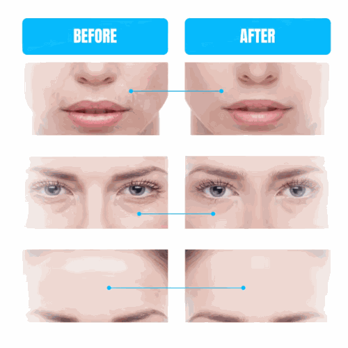 Microcurrent Facial Toning Device