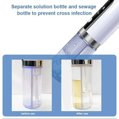 BubbleVac Electric Blackhead Remover