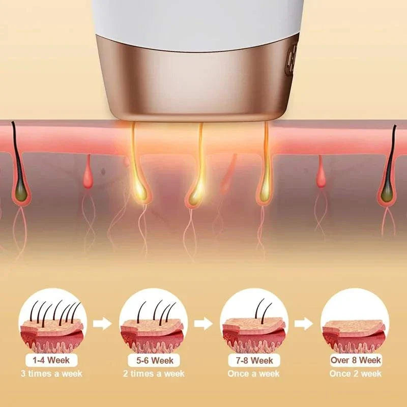 Elynoura™ SilkSkin IPL Depilator