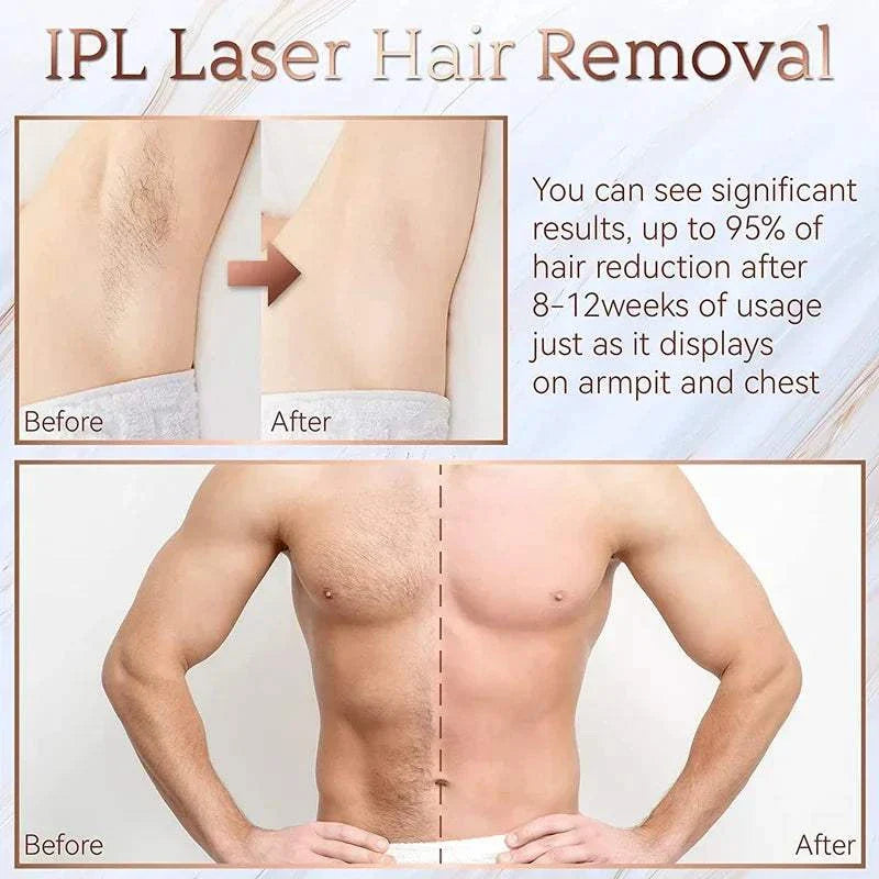 Elynoura™ SilkSkin IPL Depilator