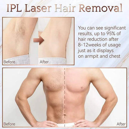 Elynoura™ SilkSkin IPL Depilator