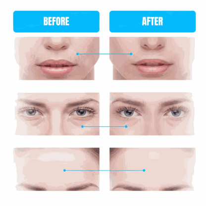 Microcurrent Facial Toning Device